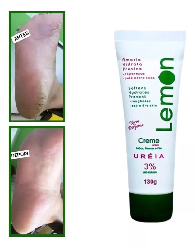 Creme Ureia 3% Pele Extra Seca 45g