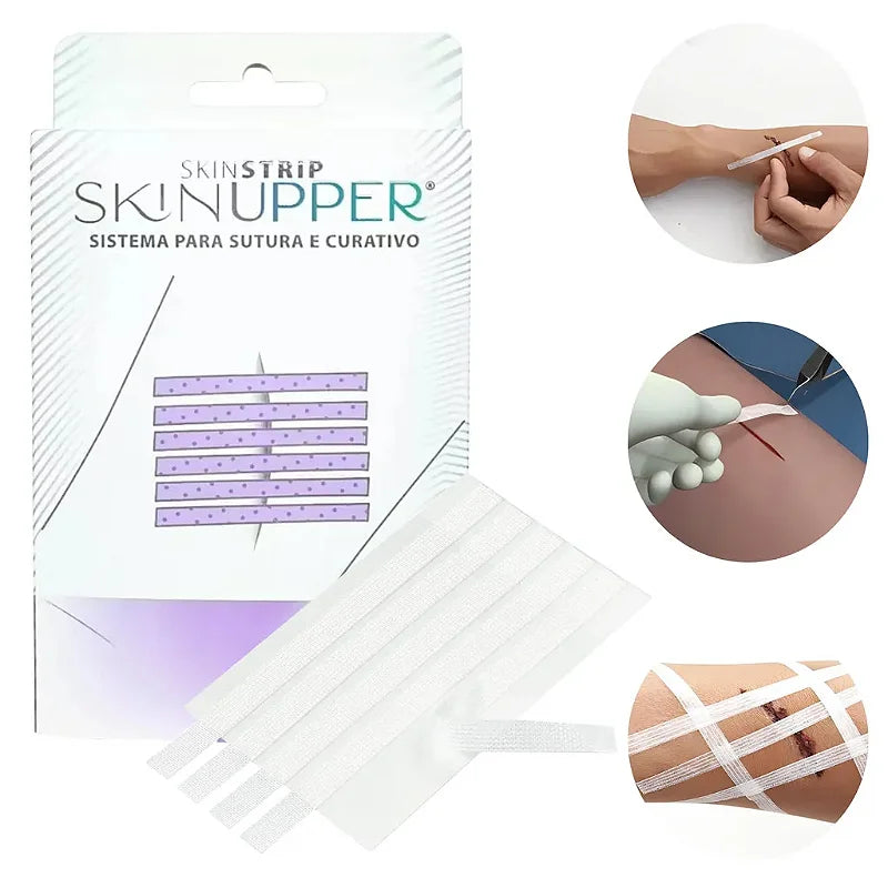 Sistema para Sutura e Curativo Skinupper — foto 2
