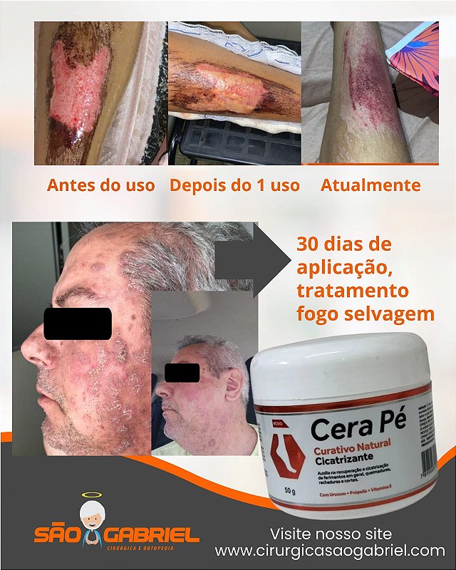 Cera Pé Curativo Natural Cicatrizante 50g — foto 2